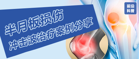 半月板损伤电磁式冲击波治疗方案案例分享