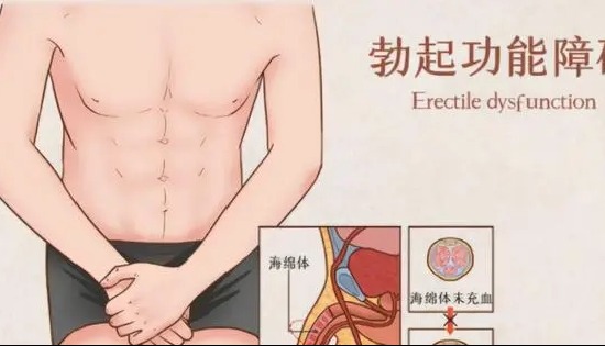 勃起功能障碍的非药物治疗手段：低强度体外冲击波疗法！